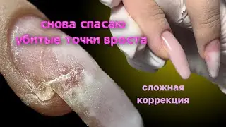 бедные ногти 😰 сложная коррекция, смена формы, креативный дизайн