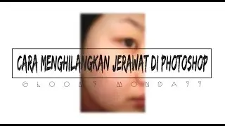 How To Remove Acne In Photoshop | Photoshop Basics Tutorial