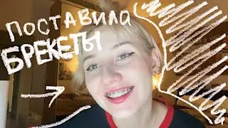 Я ПОСТАВИЛА БРЕКЕТЫ 2 раз…) влог