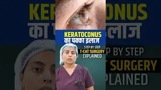Keratoconus Treatment | T-Cat + C3R Procedure