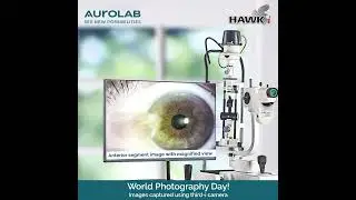World Photography Day | Third-i | Aurolab