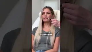 ВСЕГО 1 ПРОЦЕДУРА ВЕРНЕТ МОЛОДОСТЬ !