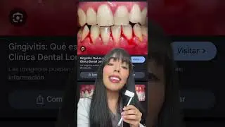 Datos que no sabías sobre los CIGARRILLOS ELECTRONICOS 😨 #shorts