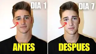 Cómo Desaparecer las Ojeras en 7 Días Sin Esfuerzo