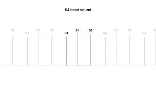 S4 Heart Sound for USMLE.