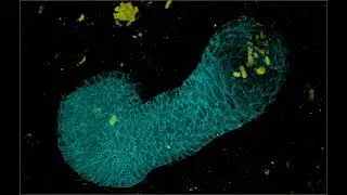 JID June 2024 Cover: Mammary bud epithelium (TO EDIT)