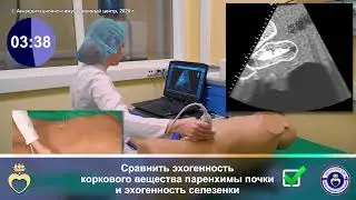 УЗИ левой почки