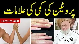 Protein Deficiency: Hidden Causes and Natural Solutions lecture 460