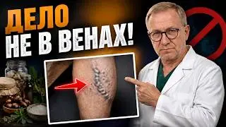 The Hemodynamic Paradox: Why the Main Problem with Varicose Veins Isn't the Veins at All? 🔬