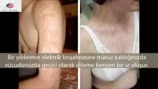 “Yok Artık!” Dedirten 13 Olay