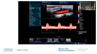 How to optimize PW Doppler on Mindray Z60
