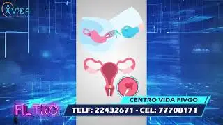 Centro Vida FIVGO próximamente en Santa Cruz!