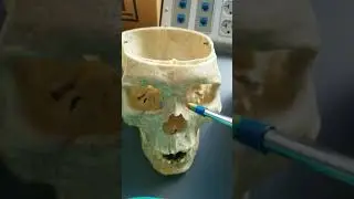 Bone shapes