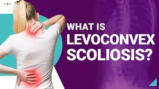 What is Levoconvex Scoliosis?