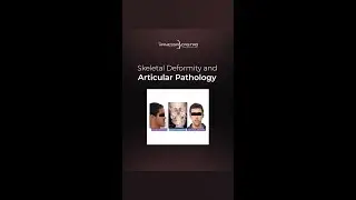 Temporomandibular Joint Diseases - How would you do it?