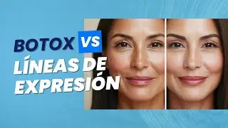 ¿Cómo Ganar la Batalla contra las Arrugas? Botox vs  Líneas de Expresión / Odontoespecialistas