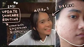 My Skincare Routine untuk kulit berjerawat dan sensitif 2021