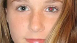 Remove Red Eye in Photoshop |