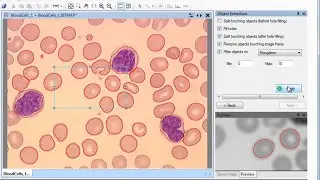 ADCIS Products : Aphelion Lab&Dev 4.0 (Image Analysis Software) : Object Extraction Task