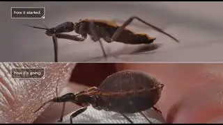 See how the bedbug drinks blood and saves it😳
