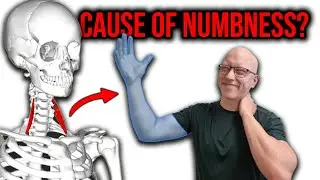 This small muscle causes numb hands & neck pain. Release it!