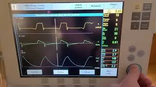 Servo i - Insp and Exp Holds and Pocc Maneuver