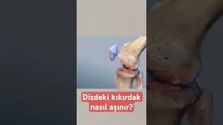 Dizdeki kıkırdak nasıl aşınır? #aktifizyo #fiziktedavi #kıkırdakerimes