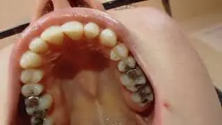 Mouth Tour