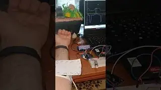 Простий давач м'язової активності / Simple muscles sensor 