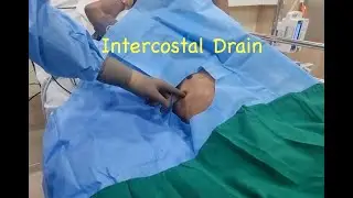 Chest Drain / Intercostal Drain /  ICU Bed side procedure / Haemothorax Drainage