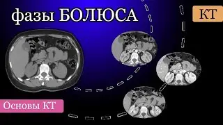 Phases of bolus contrast in CT