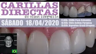 CONVERSATORIO 26 | Carillas directas con resina compuesta | Fábio Sene