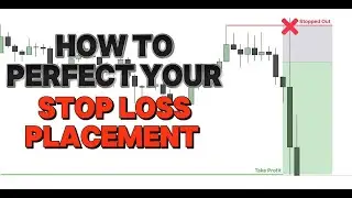 Where to Place your Stop Loss in Trades