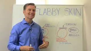 Skin Tightening – How to Get Rid of Loose Flabby Skin – Dr.Berg