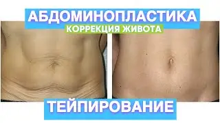 Как убрать лишнюю кожу на животе? КАК УБРАТЬ ЖИВОТ? #тейпирование