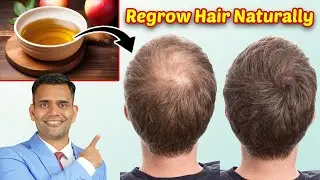 Stop Hair Fall , Hair Thinning and Regrow Hair Naturally - Dr. Vivek Joshi