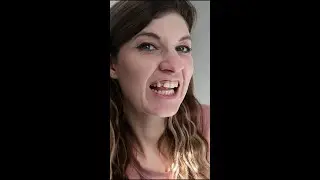'I cried when I got my instasmile veneers' (1).mov