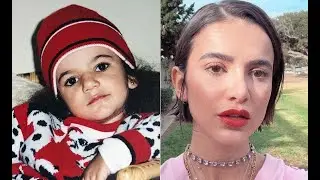 Manu Gavassi Antes e Depois - Cirurgia no Nariz