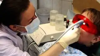 Чистка зубов в клинике Вивап-Дент