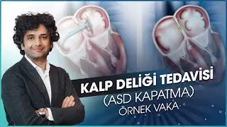 ASD KAPATMA | Örnek Vaka