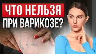 Как избавиться от варикоза в домашних условиях. Топ-3 средства для здоровья вен.