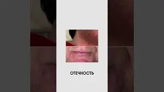 Покраснения и зуд от косметики после бритья