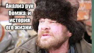 Анализ рук бомжа и история его жизни. 