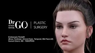 Brow, Forehead, Temporal, Almond Eyes, Mid Face Lift (Endoscopic Pentalift) Assoc.Prof.Guncel Ozturk