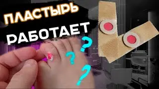 ✅ Пластырь с Алиэкспресс Реально Работает ? ? ? Мой личный опыт