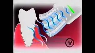 Ultrasonex