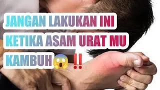 Hal yang perlu diperhatikan saat asam urat lagi kambuh, jangan dipijat ya