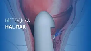 Методика HAL-RAR
