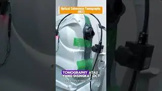 👀 OCT sudah ada di RSUD Bali Mandara looo❗️