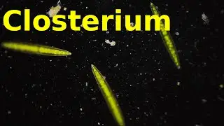 Closterium